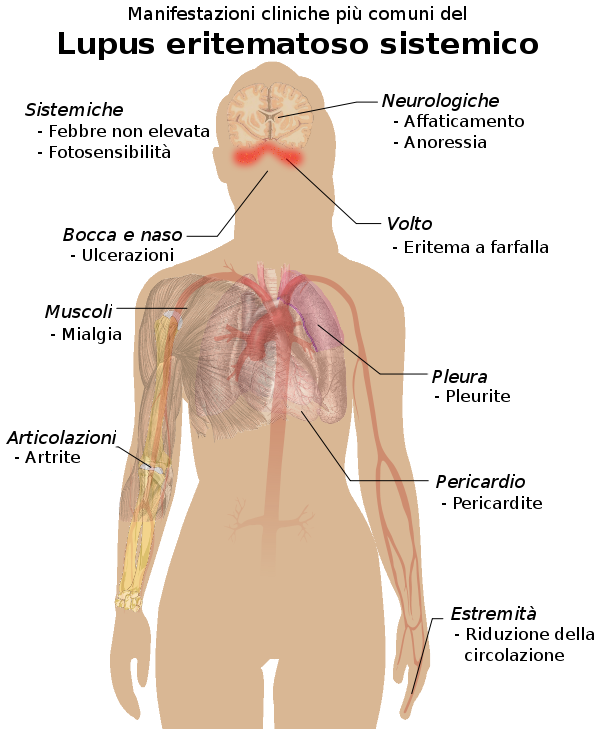 Studio medico Gallotti - connettivite